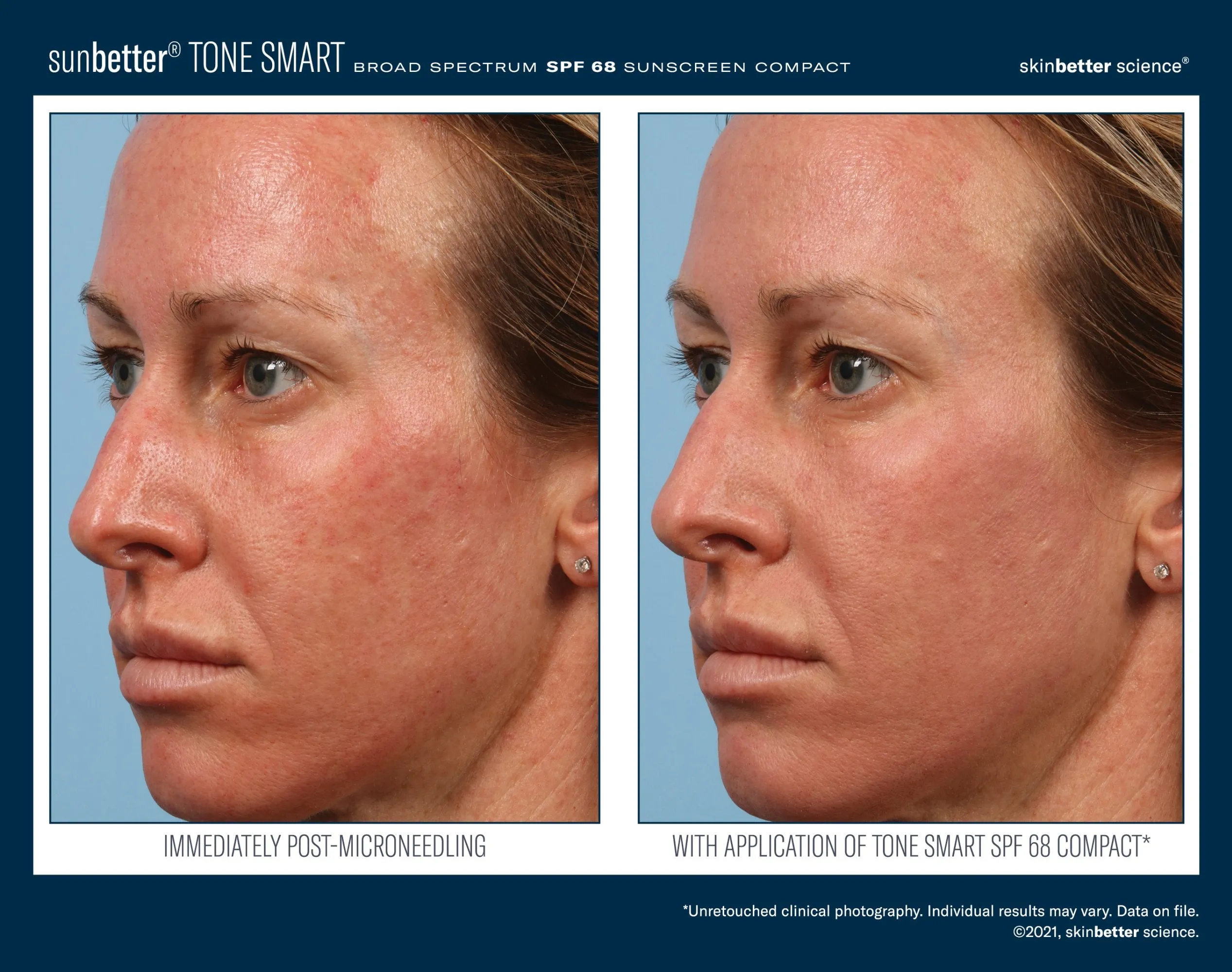 SKINBETTER Tone Smart SPF 68 Sunscreen Compact